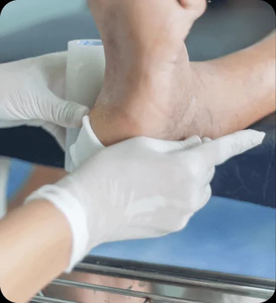 HBOT for Diabetic Wounds & Foot Ulcers | Bay Area Hyperbarics