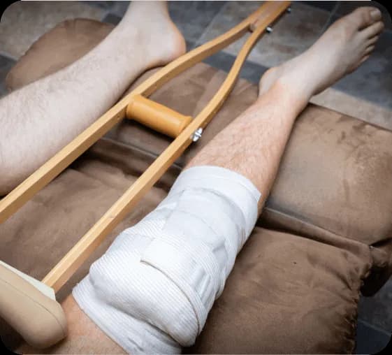 HBOT for Osteomyelitis & Bone Infections | Bay Area Hyperbarics