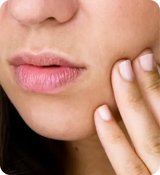 HBOT for Radiation Damage to Mouth & Jaw | Bay Area Hyperbarics